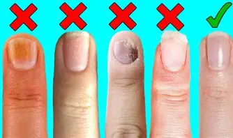 AppaNail Supplement support nails health